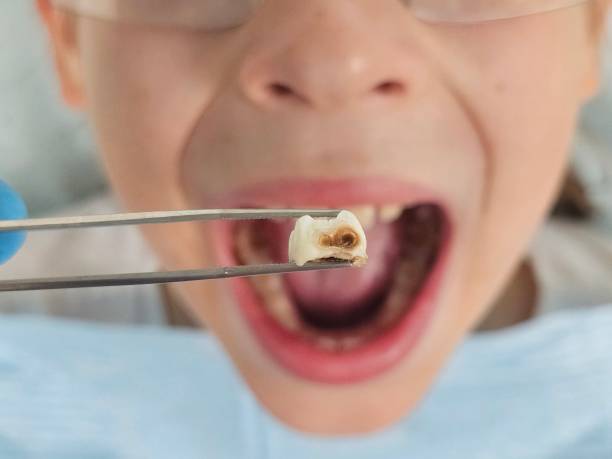 Best Weekend Emergency Dentist in Tonto Basin, AZ